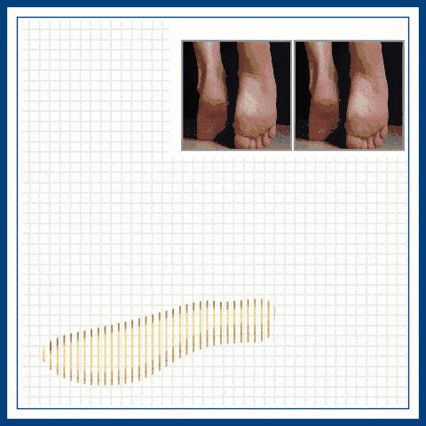 Open Toe Flat Sandals